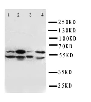 Polyclonal Rabbit anti-Human SPTLC1 / HSN1 Antibody (aa138-154, IHC, WB)