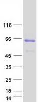 Human CRTAP Protein (Recombinant Myc-DDK (Flag))