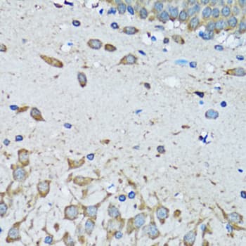 FDFT1 / Squalene Synthase Antibody