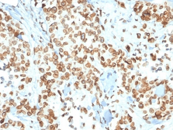 EMD / Emerin Antibody (clone EMD/2167)