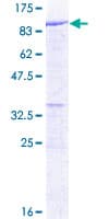 Human DYNC1I2 / IC2 Protein (Recombinant GST)