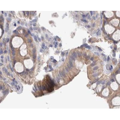 SRC Antibody (phospho-Tyr418)