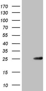 ABCC5 / MRP5 Antibody (clone OTI5A8)