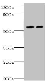 P5CDH / ALDH4A1 Antibody (aa354-563)