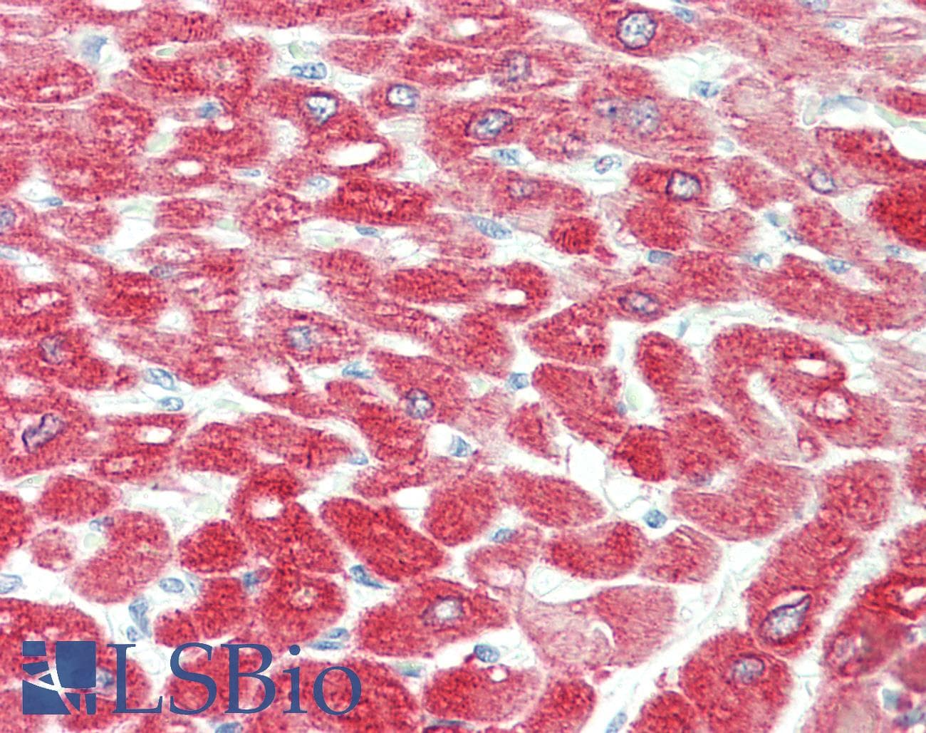 IHC-plus™ CRYAB / Alpha B Crystallin Antibody (clone 6D11)