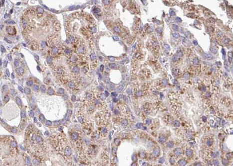 Polyclonal Rabbit anti-Human MYD88 Antibody (IHC, IF, WB)