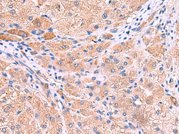 MPP1 Antibody