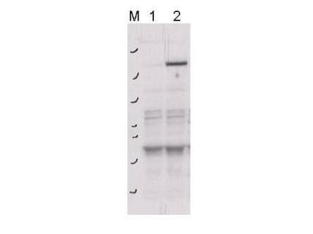 ROCK2 Antibody (phospho-Tyr256)