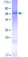 Human WNT5A Protein (Recombinant GST)