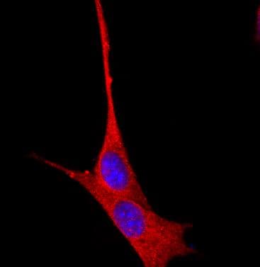 PathPlus™ Actin Antibody (clone mAbGEa)