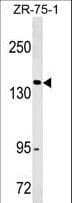 Monoclonal Mouse anti-Human ITGAX / CD11c Antibody (aa246-274, WB)