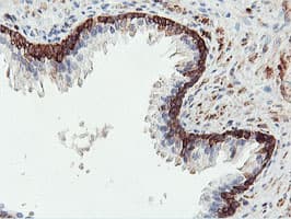 Monoclonal Mouse anti-Human PFKP Antibody (clone OTI3A12, IHC, IF, WB)