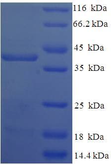 Human TGIF2LX Protein (Recombinant His-SUMO)