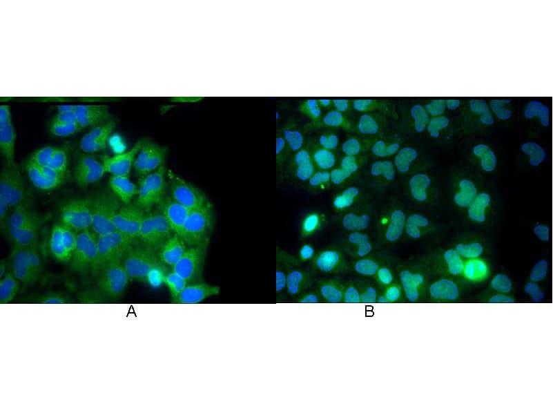 Monoclonal Mouse anti-Human RELA / NFKB p65 Antibody (clone 27F9.G4, C-Terminus, IHC, IF, WB)