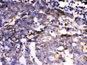 MAPK6 / ERK3 Antibody