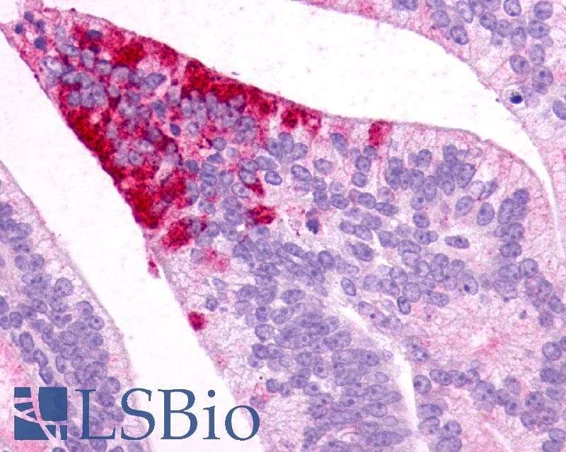IHC-plus™ Polyclonal Rabbit anti-Human MC5R / MC5 Receptor Antibody (N-Terminus, IHC)