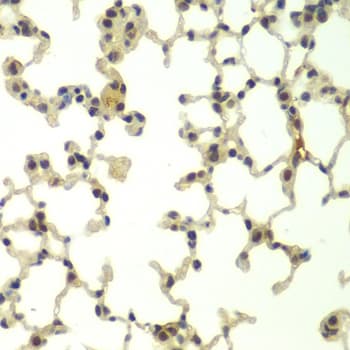 Polyclonal Rabbit anti-Human FBXW11 Antibody (IHC, IF, WB)