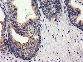 RTN4IP1 / NIMP Antibody (clone OTI3B2)