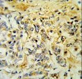 Polyclonal Rabbit anti-Human LMBR1L Antibody (aa462-489, IHC, WB)