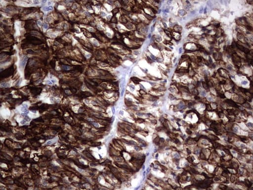 Monoclonal Mouse anti-Human KRT19 / CK19 / Cytokeratin 19 Antibody (clone OTI6E8, aa240-390, IHC)