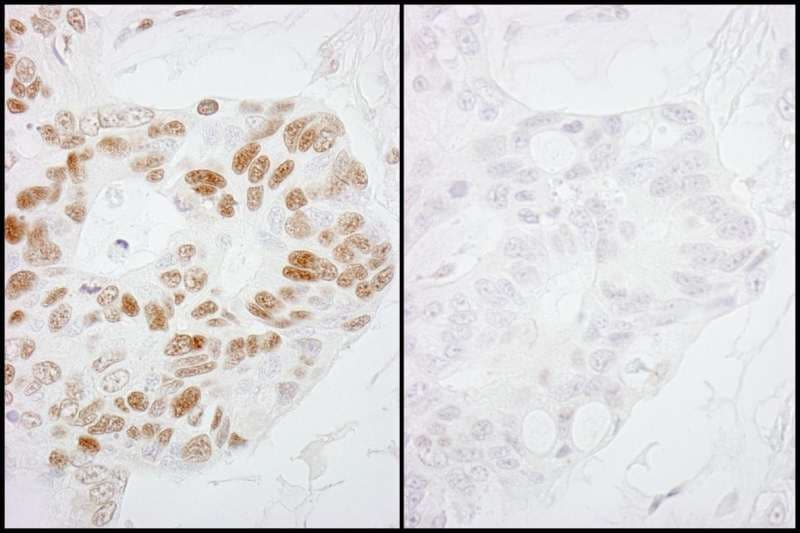 Polyclonal Rabbit anti-Human POLR2A / RNA polymerase II Antibody (phospho-Ser2, IHC)