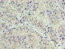 Polyclonal Rabbit anti-Human GAN Antibody (aa1-240, IHC)