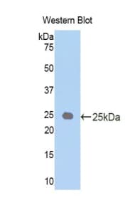 IL6 / Interleukin 6 Antibody (aa21-211, Cy3)