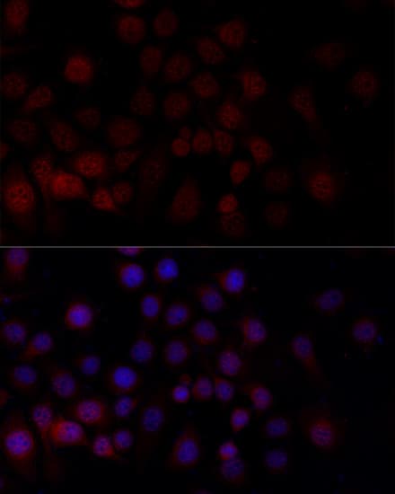 Polyclonal Rabbit anti-Human CASP9 / Caspase 9 Antibody (IHC, IF, WB)