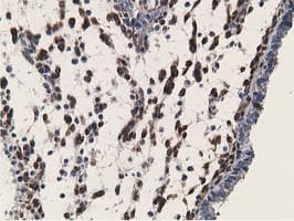RBP1 / CRBP Antibody (clone OTI2H3)