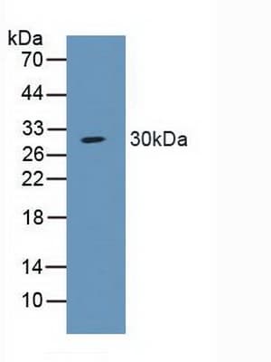 SCNN1A / ENaC Alpha Antibody (aa112-543, PE)