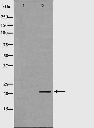 Polyclonal Rabbit anti-Human CSRP1 Antibody (IHC, WB)