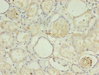 PLCD4 Antibody (aa1-762)