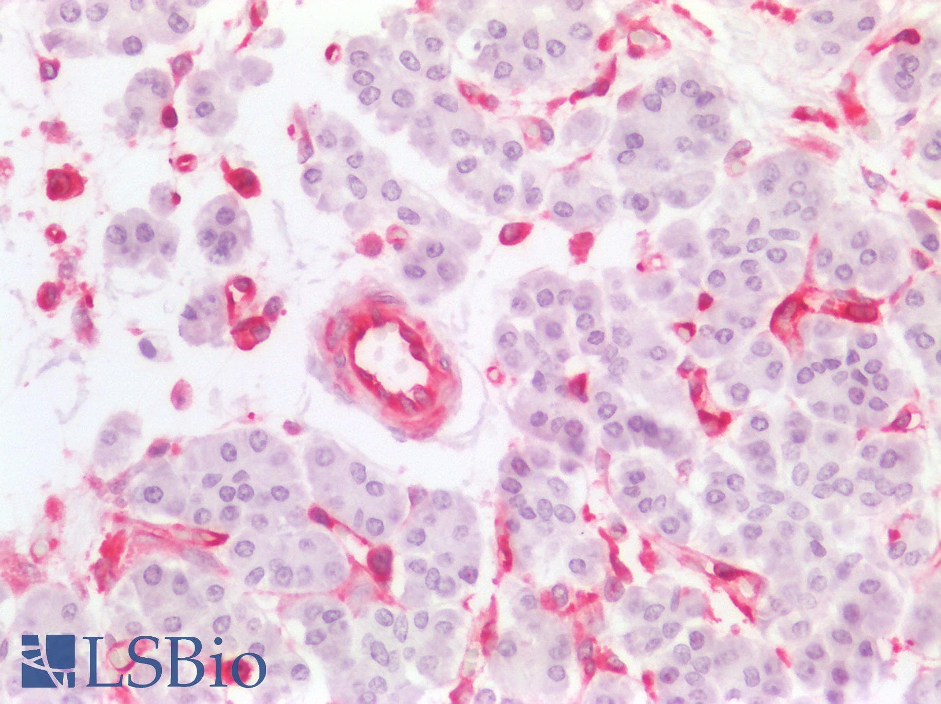 PathPlus™ Monoclonal Mouse anti-Human MSN / Moesin Antibody (clone 2C12, aa292-491, IHC, WB)