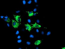 SIRT5 / Sirtuin 5 Antibody (clone OTI2C4)