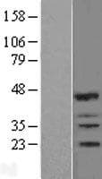 RNF144B Protein (Over-Expression Lysate Myc-DDK (Flag))
