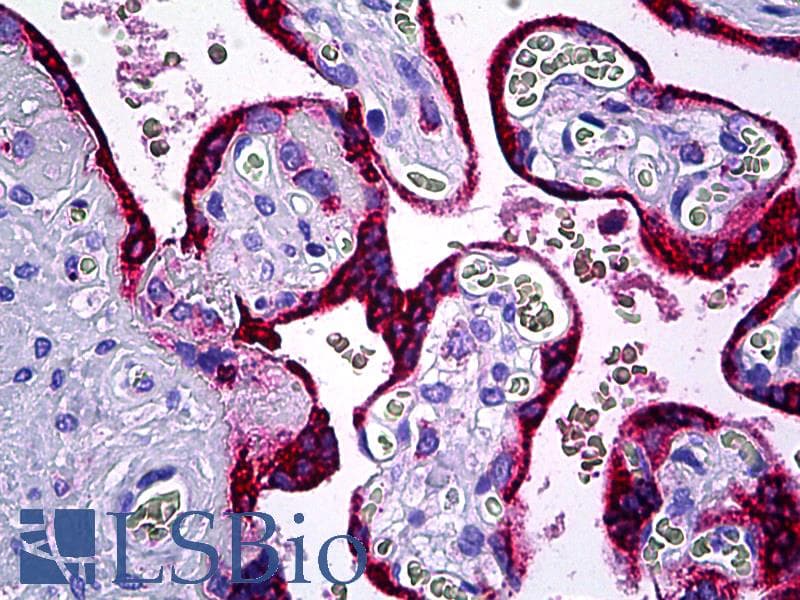 IHC-plus™ Monoclonal Rabbit anti-Human MESDC2 / MESD Antibody (clone C22F5, IHC, WB)