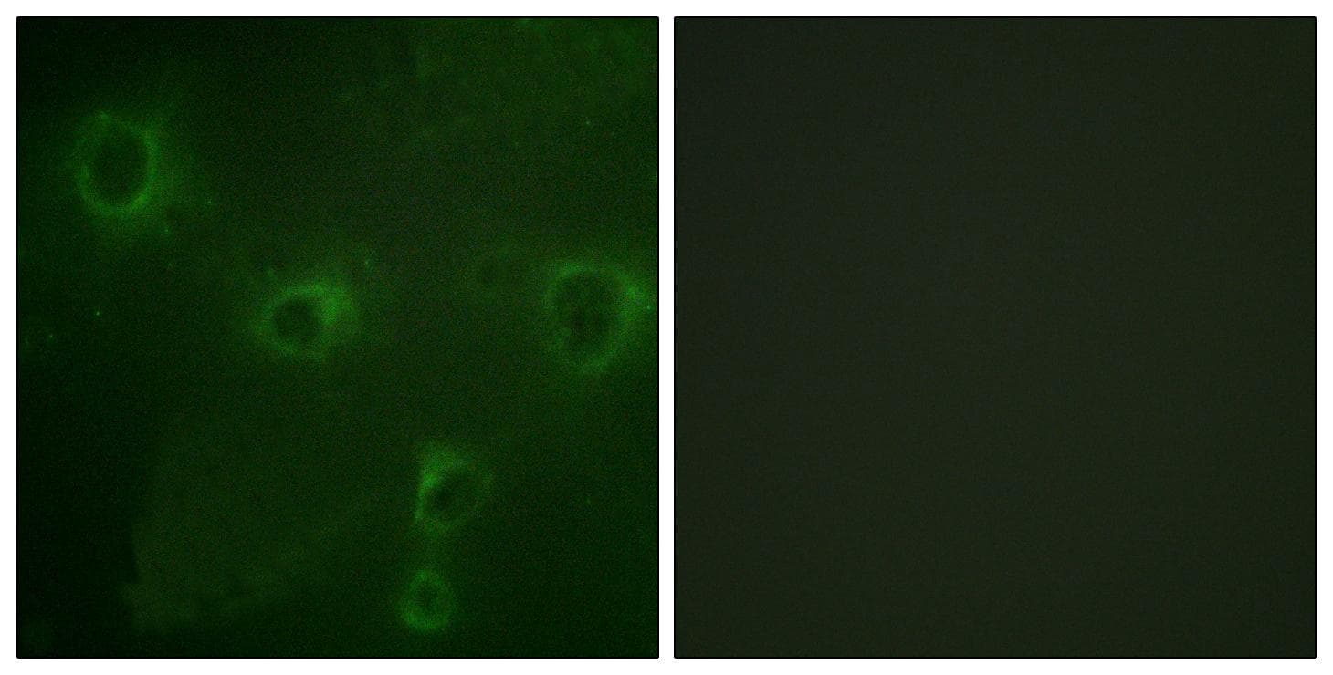 KCNB1 / Kv2.1 Antibody (Ab-567)