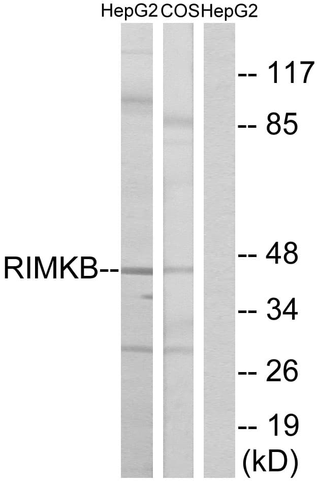 RIMKLB Antibody (aa177-226)