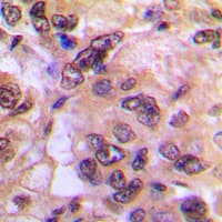 PRKACA + PRKACB Antibody (N-Terminus)