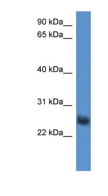 SLA2 / SLAP2 Antibody (aa94-143)