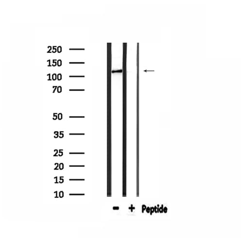 Polyclonal Rabbit anti-Human COL1A2 / Collagen I Alpha 2 Antibody (IHC, IF, WB)