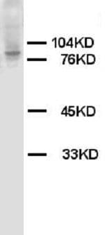 HIF2A / EPAS1 Antibody (aa202-240, Magnetic beads)
