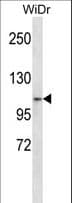 Polyclonal Rabbit anti-Human ZNF836 Antibody (aa107-135, WB)