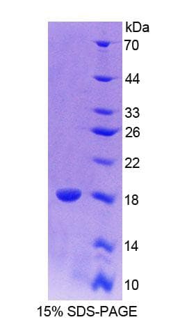 Mouse CALY Protein (Recombinant His-T7, N-terminus)