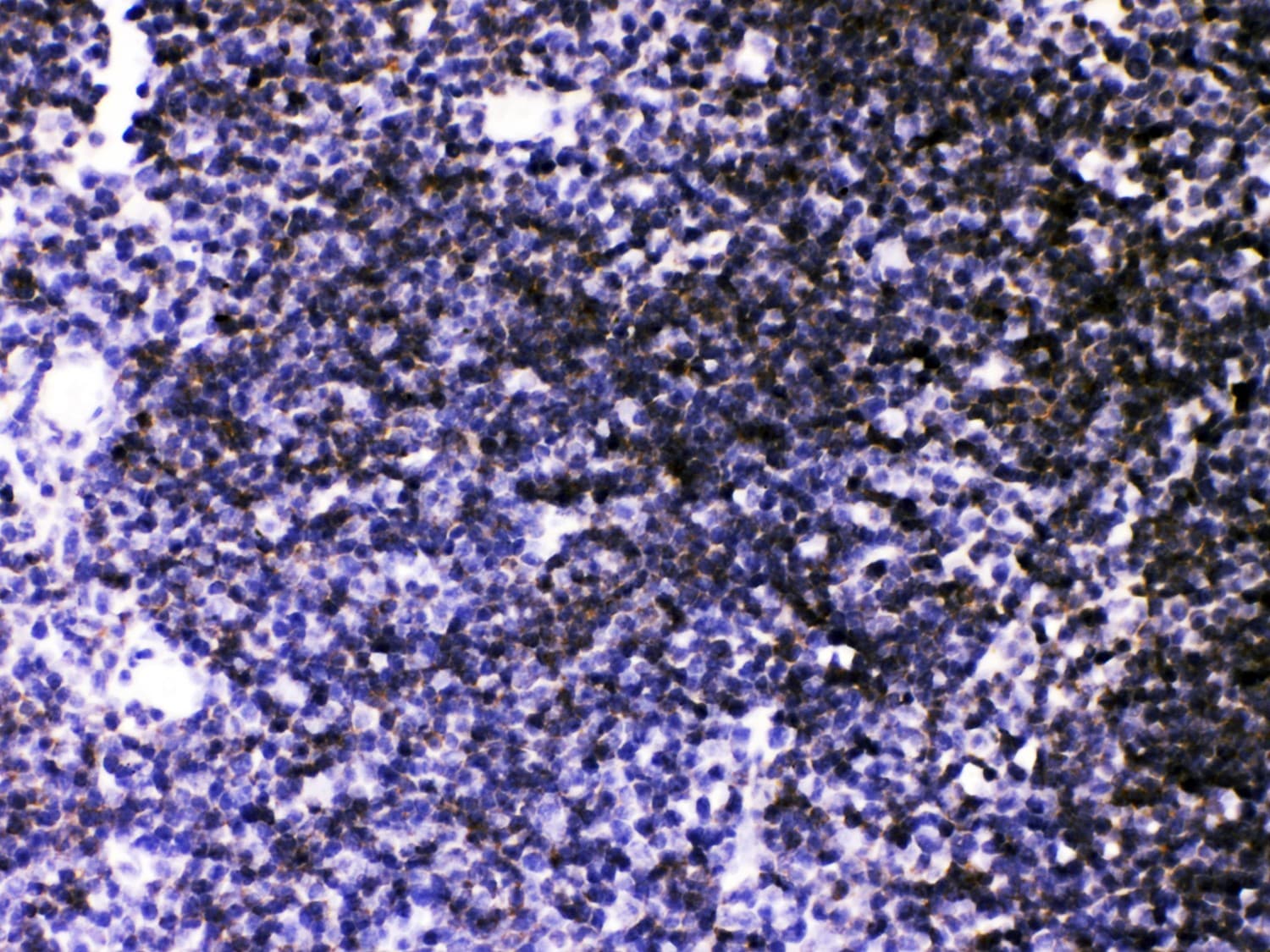 ATP2A3 / SERCA3 Antibody (aa1-30)