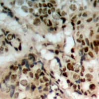 PTEN Antibody (C-Terminus)