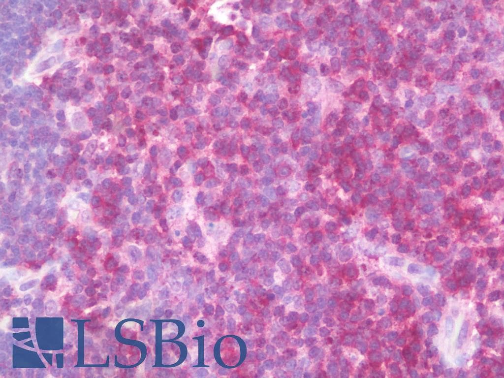 PathPlus™ CD6 Antibody