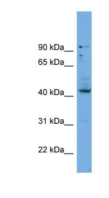 HOXB3 Antibody (C-Terminus)