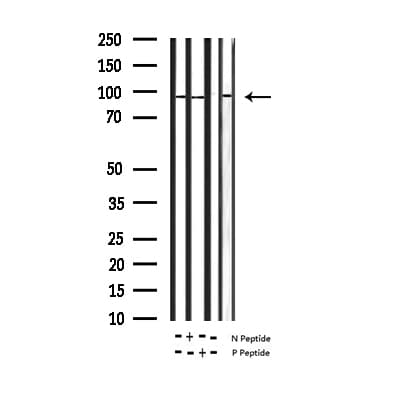 MAPT / Tau Antibody (phospho-Ser404)