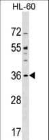 CENPO Antibody (aa42-69)